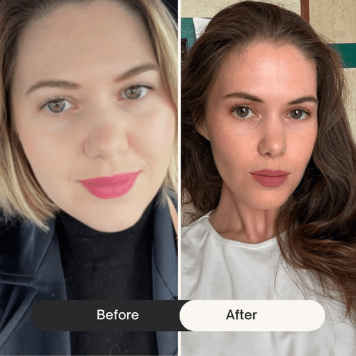 before and afters