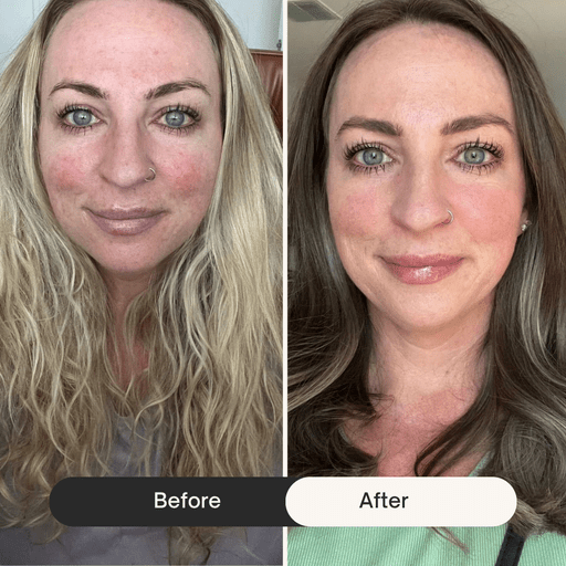 before after