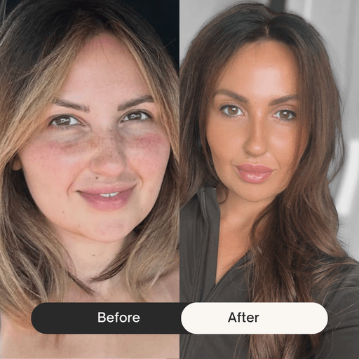 before after
