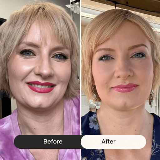 before after