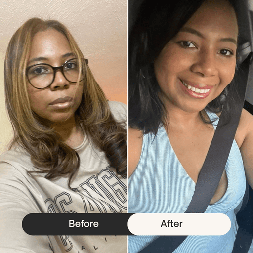 before after